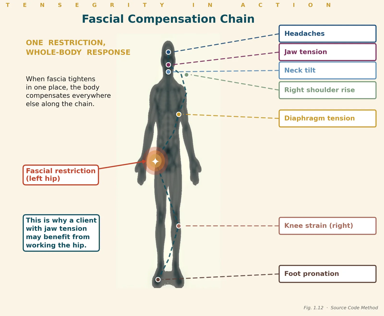 Illustration of a fascial compensation chain: one restriction at the hip pulling through the knee, diaphragm, shoulder, neck and jaw
